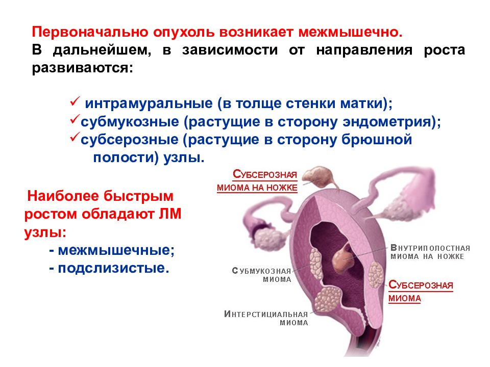 Доброкачественные новообразования женских половых органов - презентация онлайн