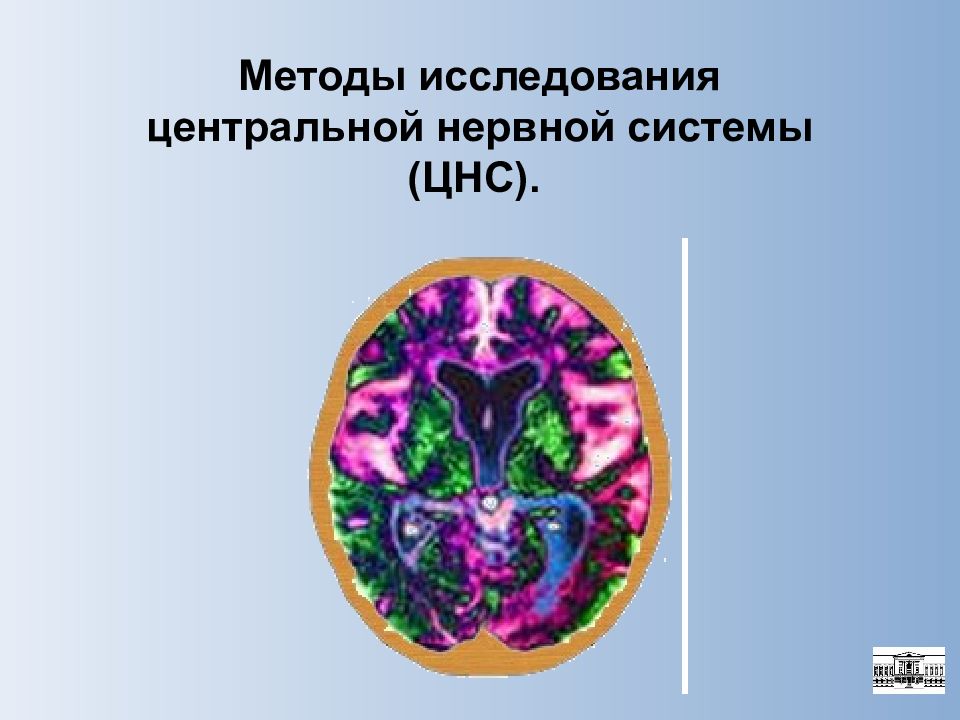 Методы исследования центральной нервной системы (ЦНС).