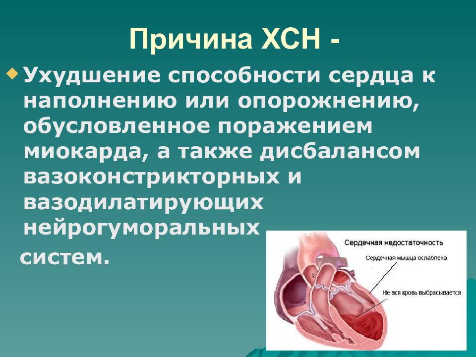 Острая и хроническая сердечная недостаточность презентация