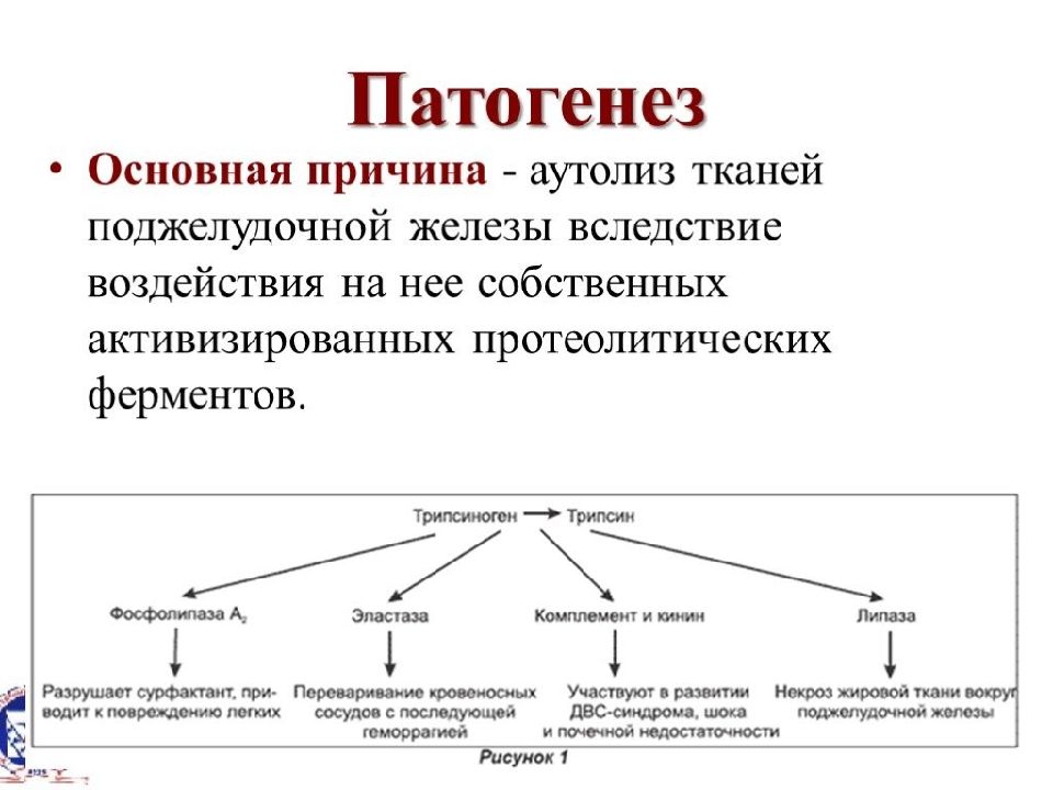 Панкреатиты у детей презентация