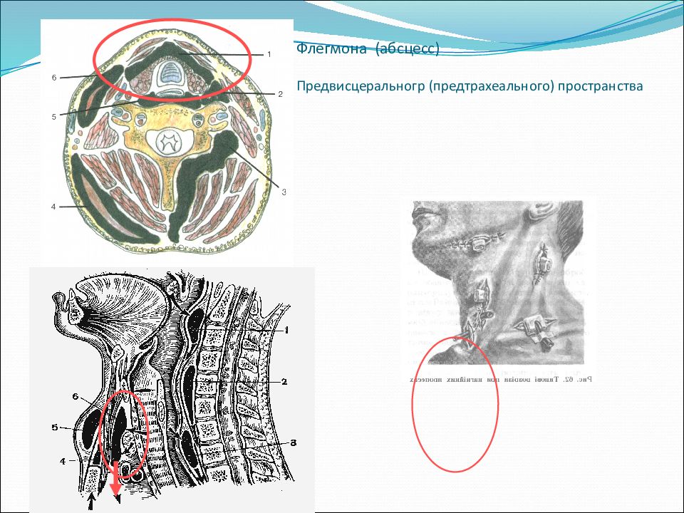 Топографическая анатомия и оперативная