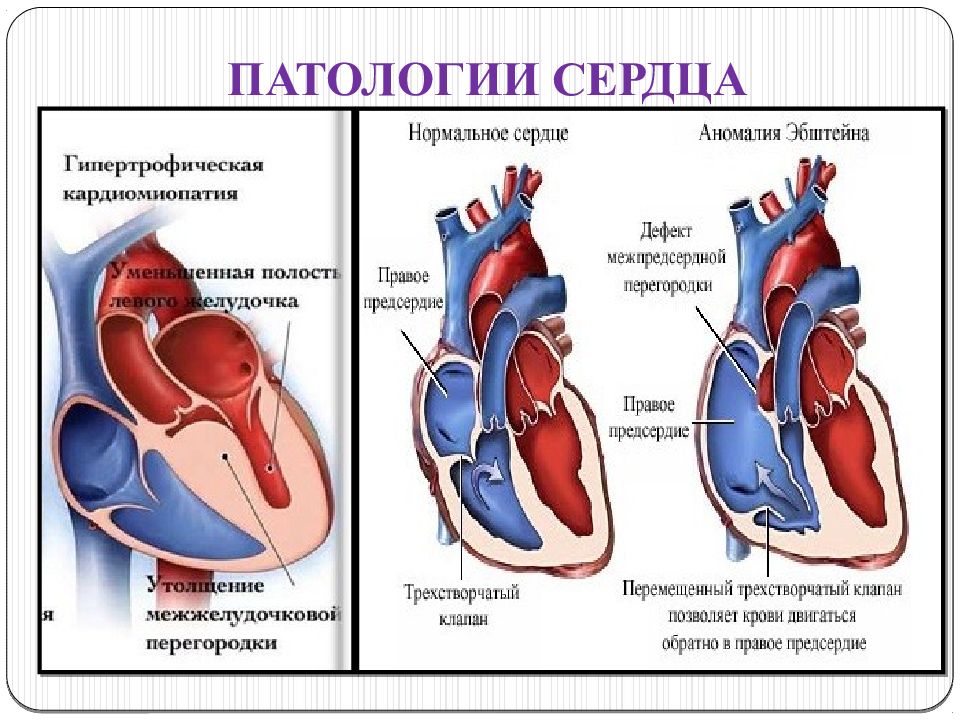 Обследование сердечно сосудистой системы