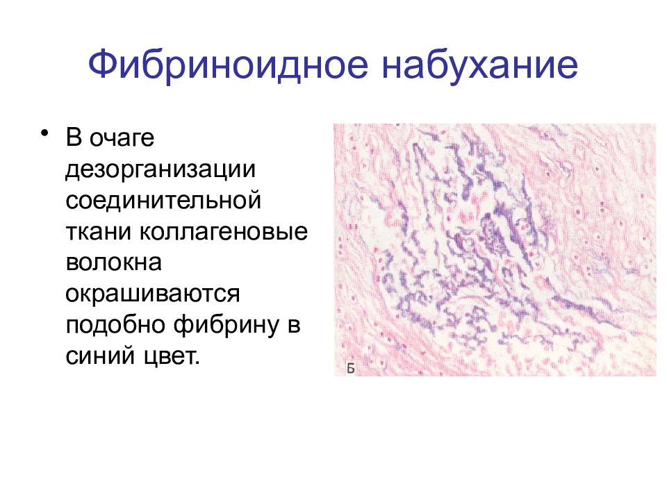 Повреждения дистрофии презентация