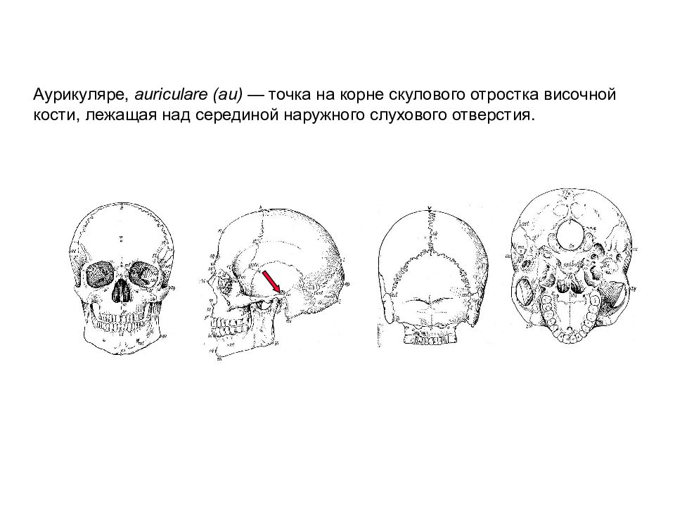 6 ая точка. Точка гнатион на черепе. Отросток височной кости антропология. Скуловой отросток височной кости. Корень скулового отростка височной кости.