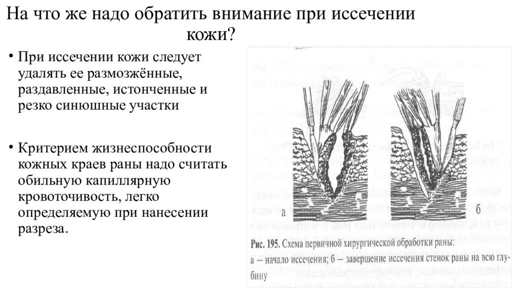 Особенности проведения пхо