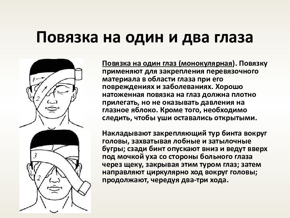 Повязка это. Наложение повязки на оба глаза. Повязка на глаз техника наложения. Наложение повязки на один глаз. Повязки на голову десмургия.