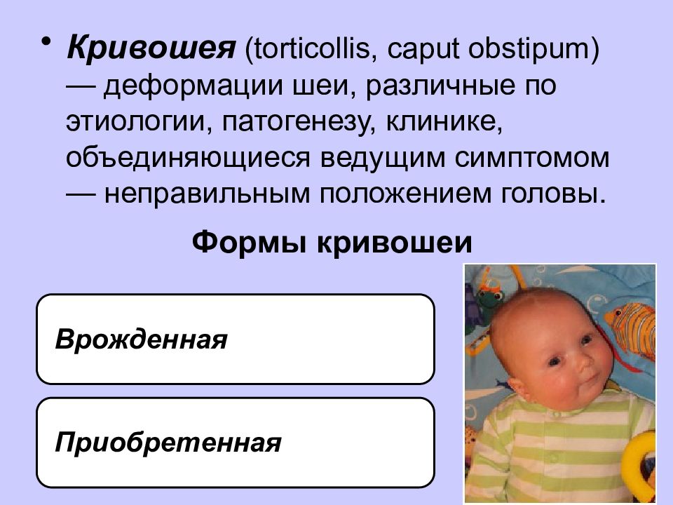 Врожденная мышечная кривошея презентация