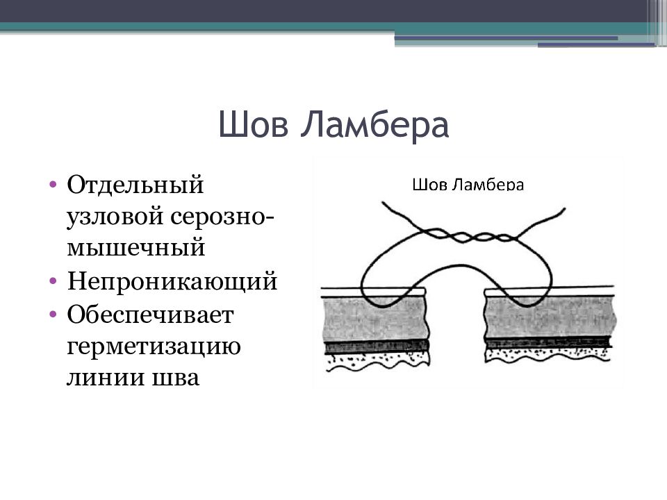 Кишечный шов