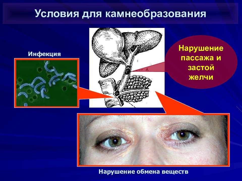 Механическая желтуха картинки