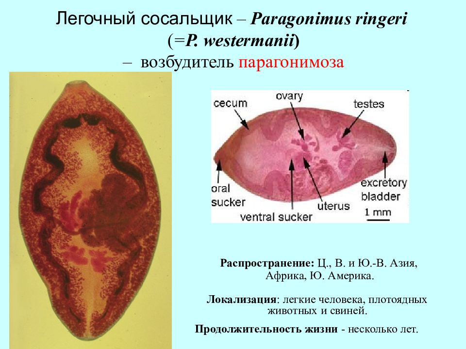 Клиническая картина парагонимоза