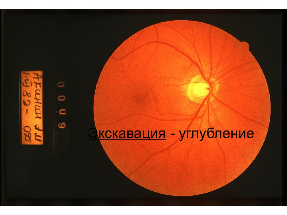Экскавация это