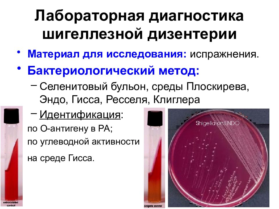 Бактериологический метод. Бактериологический метод диагностики дизентерии. Материал для бактериологического исследования при шигеллезе. Метод исследования при дизентерии. Бактериологический метод исследования дизентерии.