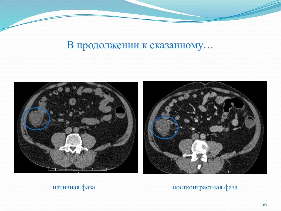 Реконструкция изображений в компьютерной томографии