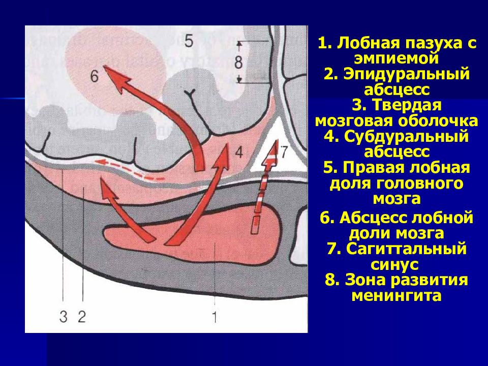 Презентация абсцесс головного мозга