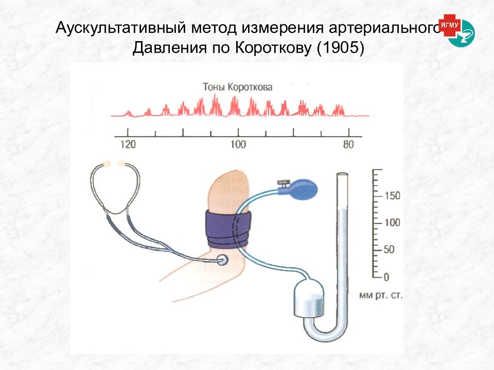 Проект методы измерения артериального давления по физике