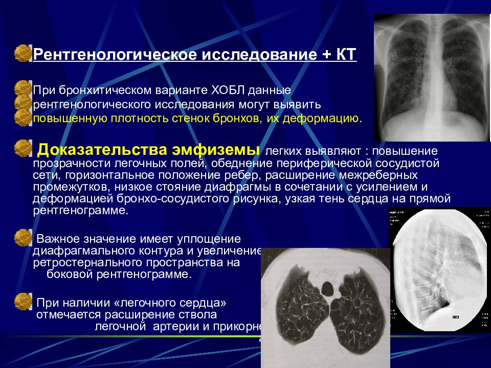 Изменения легочного рисунка по бронхитическому типу