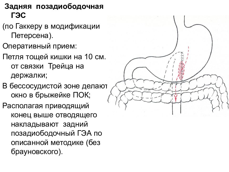 Топографическая анатомия желудка презентация