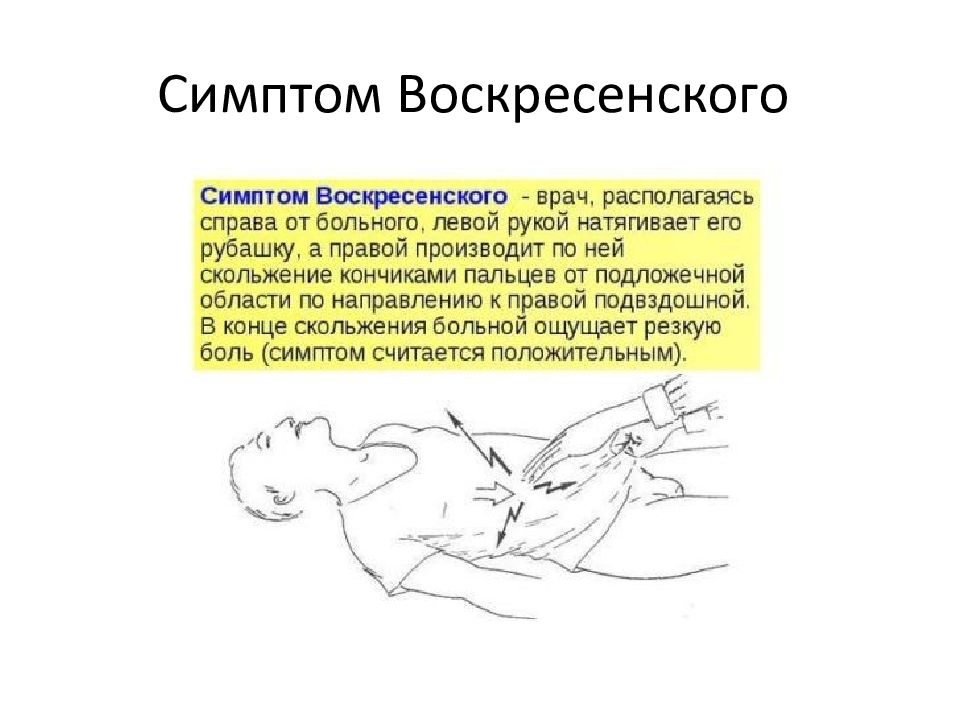 Клиническая картина острого аппендицита