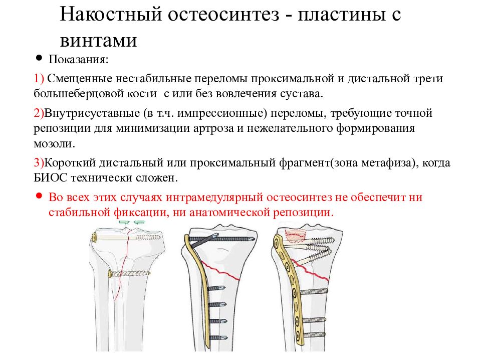 Лечение трещины кости