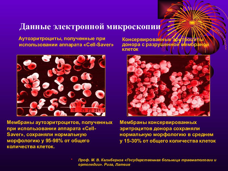 Анемия у новорожденных презентация