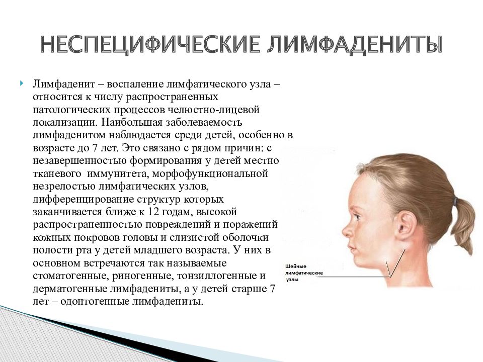 Подчелюстной лимфаденит карта вызова скорой медицинской