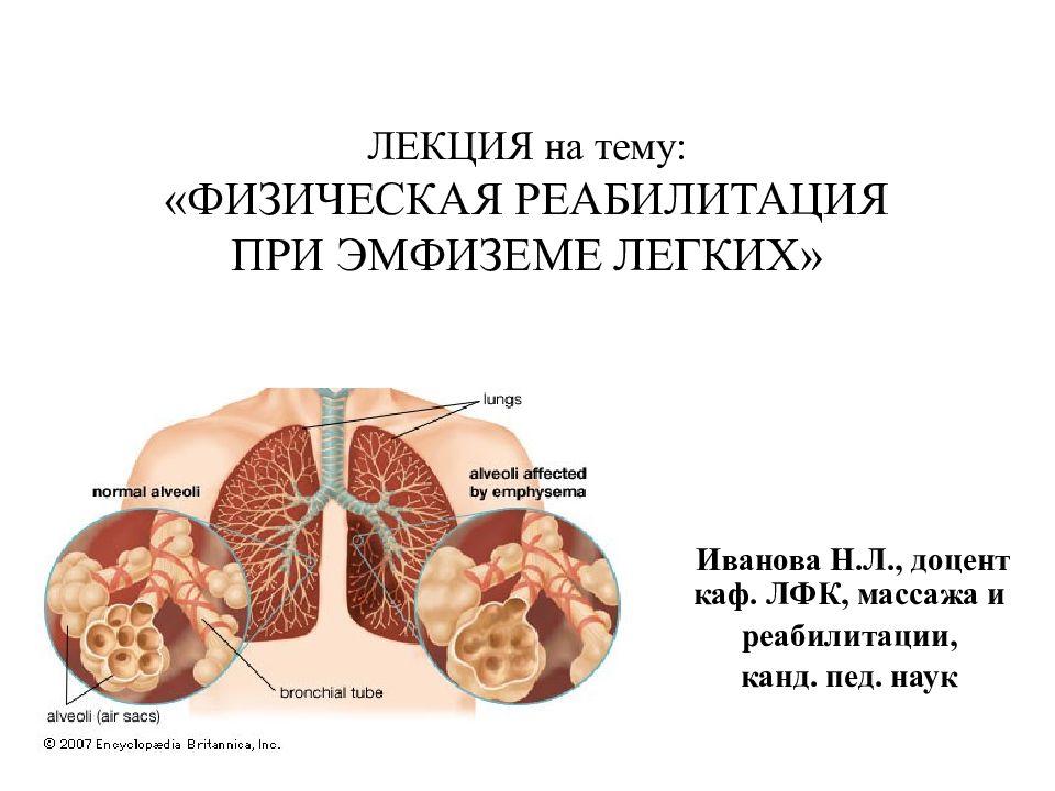 Презентация на тему эмфизема легких