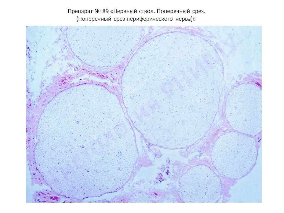 Нервный ствол. Поперечный срез периферического нерва гистология. Периферический нерв гематоксилин эозин. Нервный ствол поперечный срез препарат гистология. Поперечный срез нерва гистологический препарат.