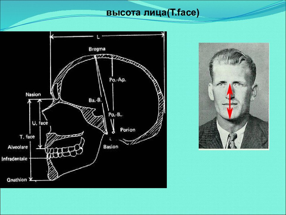 Развитие черепа в онтогенезе индивидуальные возрастные. Высота лица. Морфологическая высота лица. Физиономическая высота лица. Верхняя морфологическая высота лица.