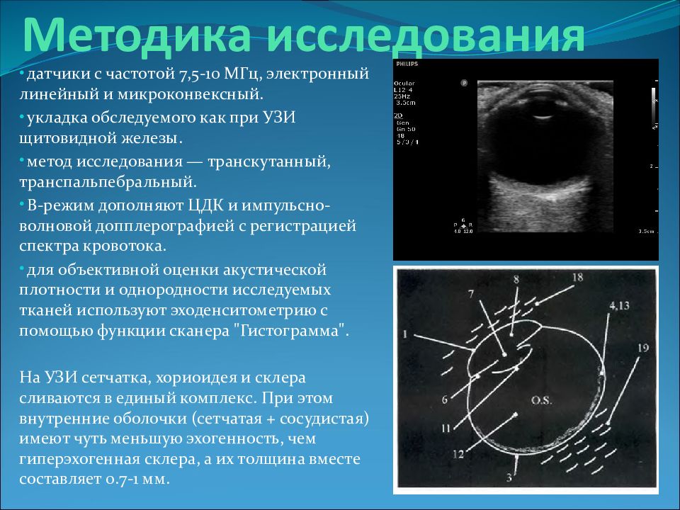 Метод перед. Методы ультразвуковой диагностики. Методика проведения УЗИ. Метод исследования хориоидеи. Методы проведения исследования УЗИ.