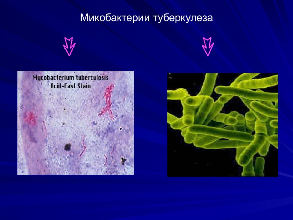 Типы микобактерий. Палочка Коха (Mycobacterium tuberculosis). Корд-фактор микобактерий туберкулеза. Бактерия Mycobacterium tuberculosis. Микобактерия туберкулеза анаэроб.