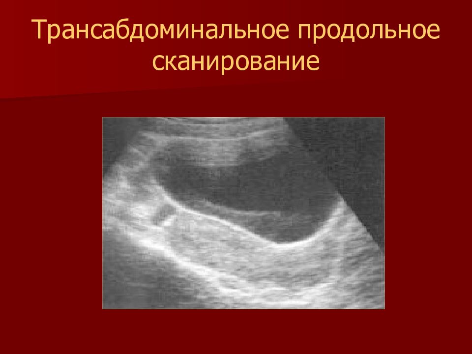 Трансабдоминальное узи. Трансабдоминальное УЗИ матки. Трансабдоминальное сканирование. Матка на УЗИ трансабдоминально. Трансабдоминальное ультразвуковое сканирование.