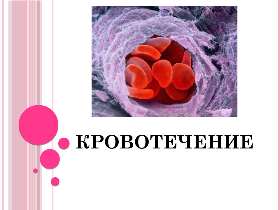 Кровотечения картинки для презентации