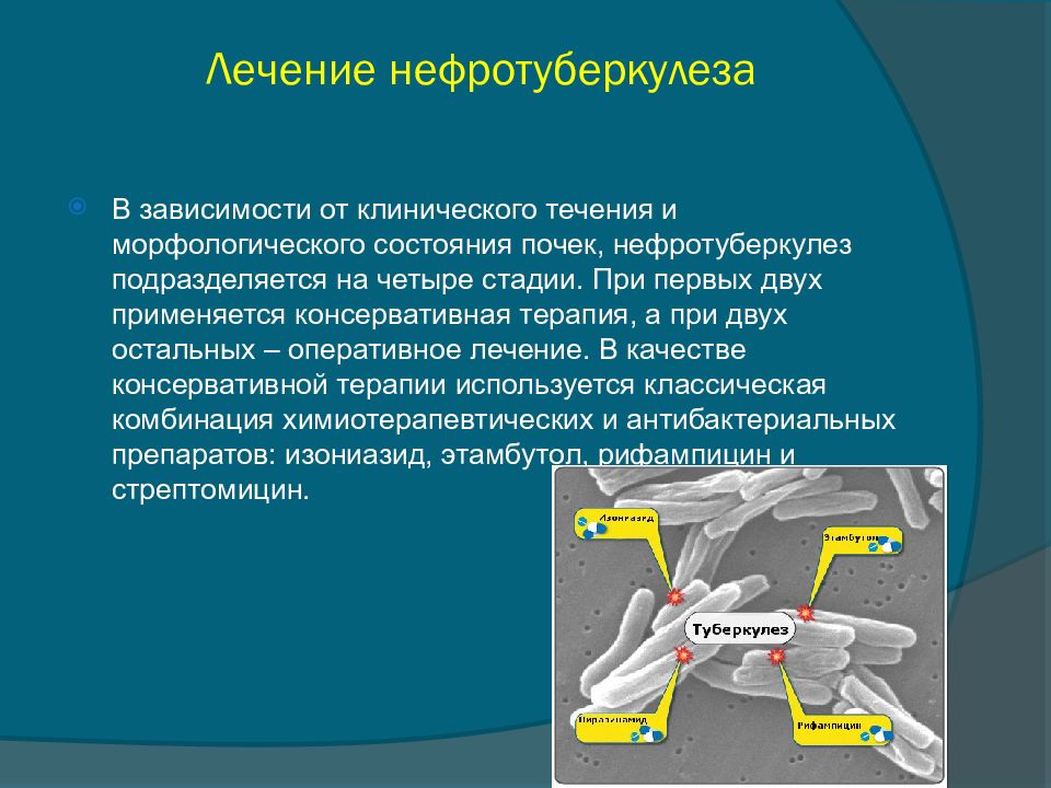 Туберкулез мочевыделительной системы презентация