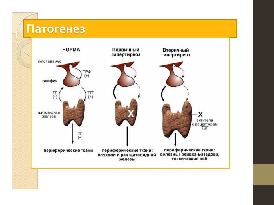 Патогенез тиреотоксикоза. Механизм развития тиреотоксикоза. Механизм развития гипертиреоза щитовидной железы. Патогенез гипотиреоза схема. Патогенез нарушения функции щитовидной железы.