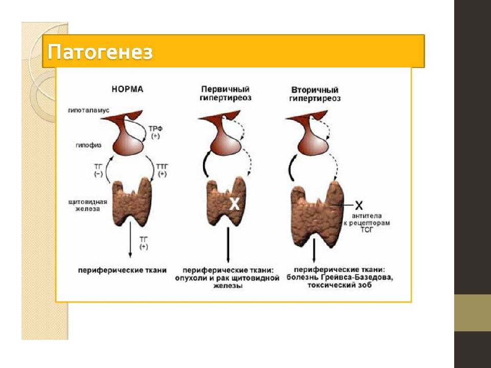 Токсический зоб этиология. Тиреотоксикоз механизм развития. Гипофункция щитовидной железы патогенез. Гиперфункция щитовидной железы патогенез. Патогенез гипотиреоза схема.