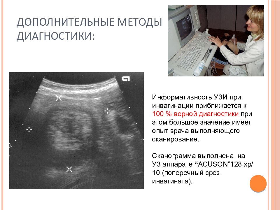 Узи кишечника как подготовиться. Острая кишечная непроходимость УЗИ. Инвагинация тонкого кишечника УЗИ. Инвагинация кишечника по УЗИ. Инвагинация кишечника на УЗИ.