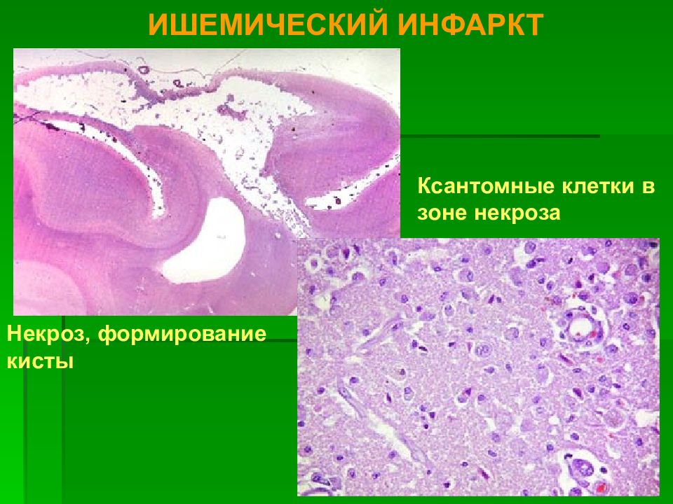 Презентация шок патанатомия