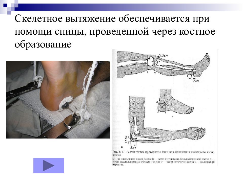 Двухлодыжечный перелом карта вызова скорой медицинской