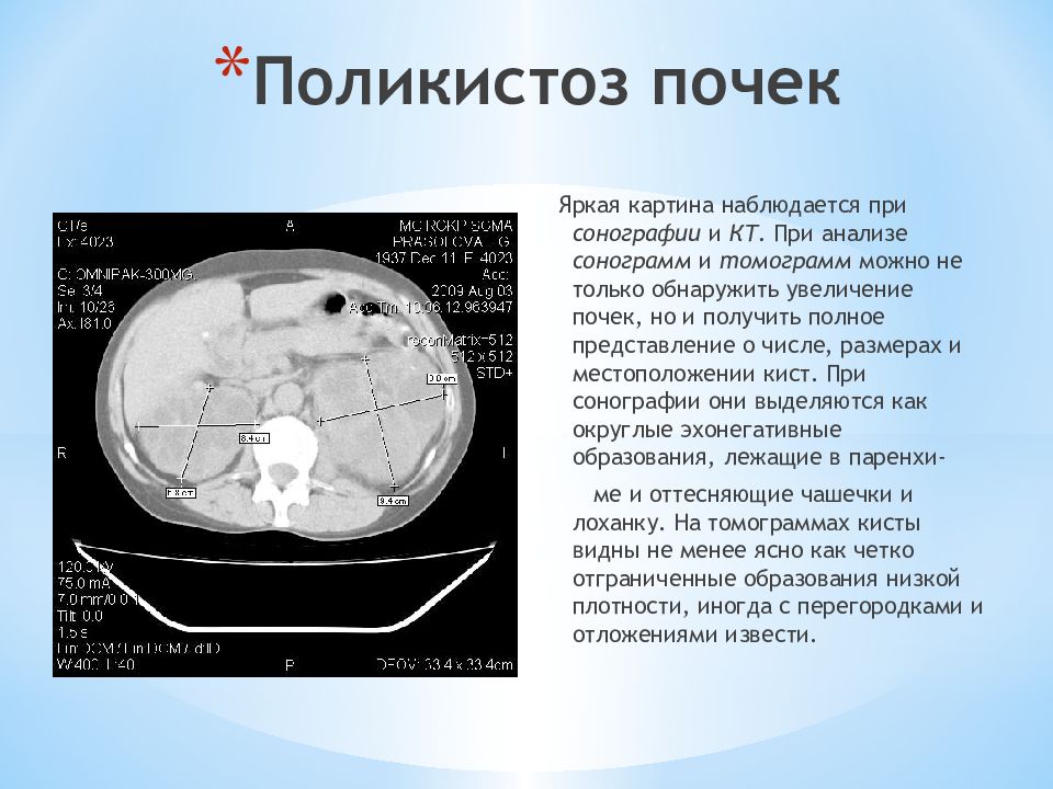 Лучевая диагностика почек презентация