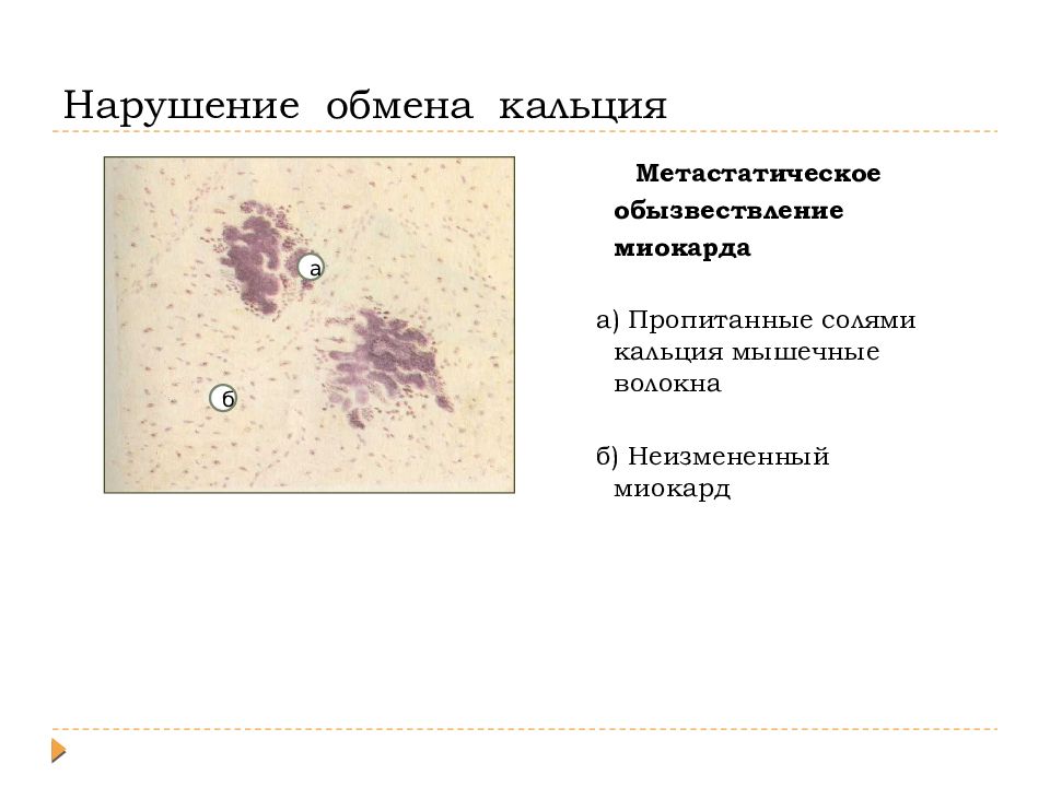 Повреждения дистрофии презентация