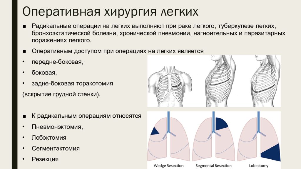 Хирургические заболевания грудной клетки