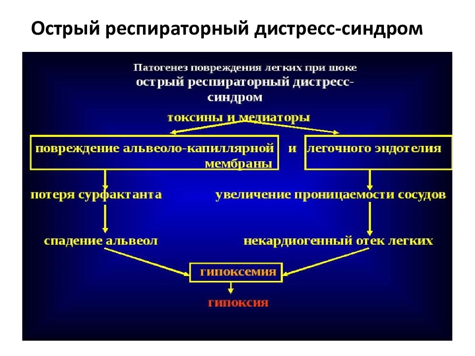 Респираторный дистресс синдром