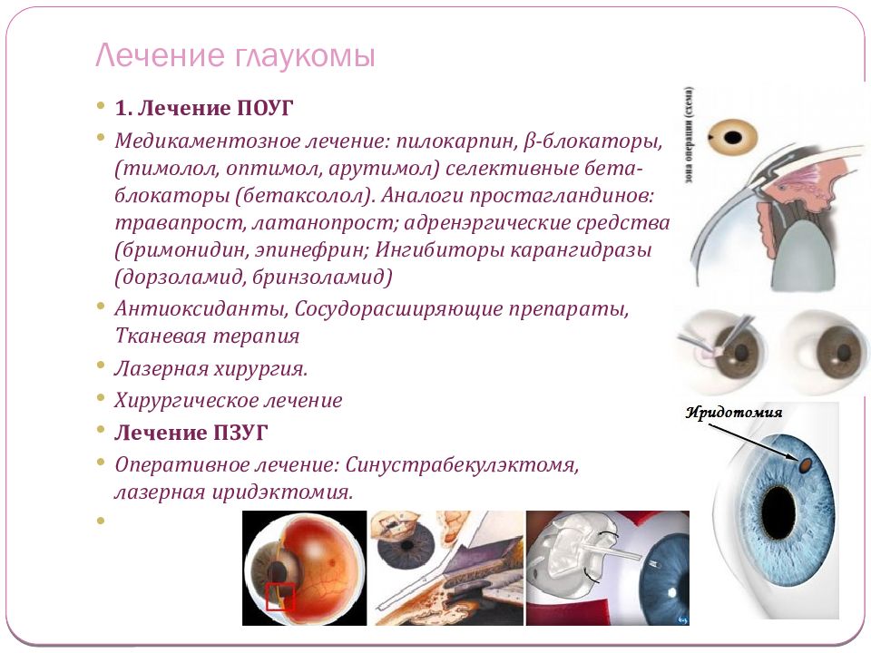 Глаукома презентация офтальмологии