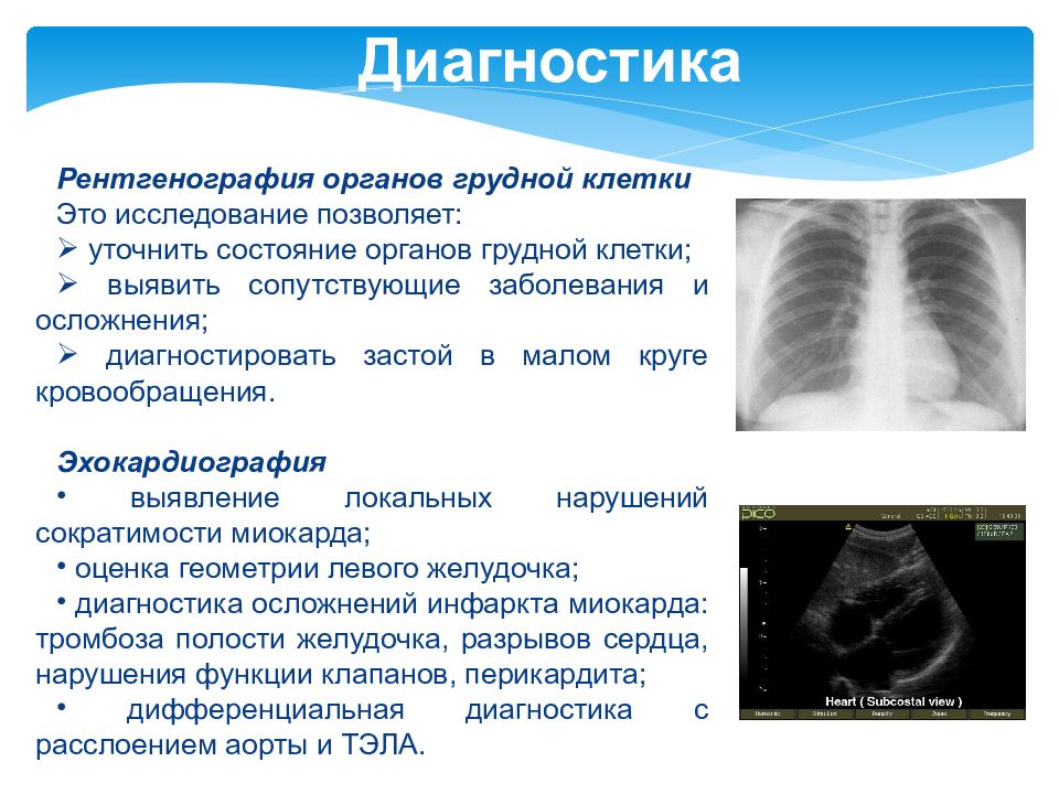 План описания рентгенограммы легких