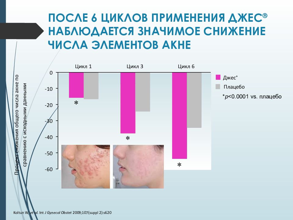 Гипоменструальный синдром презентация