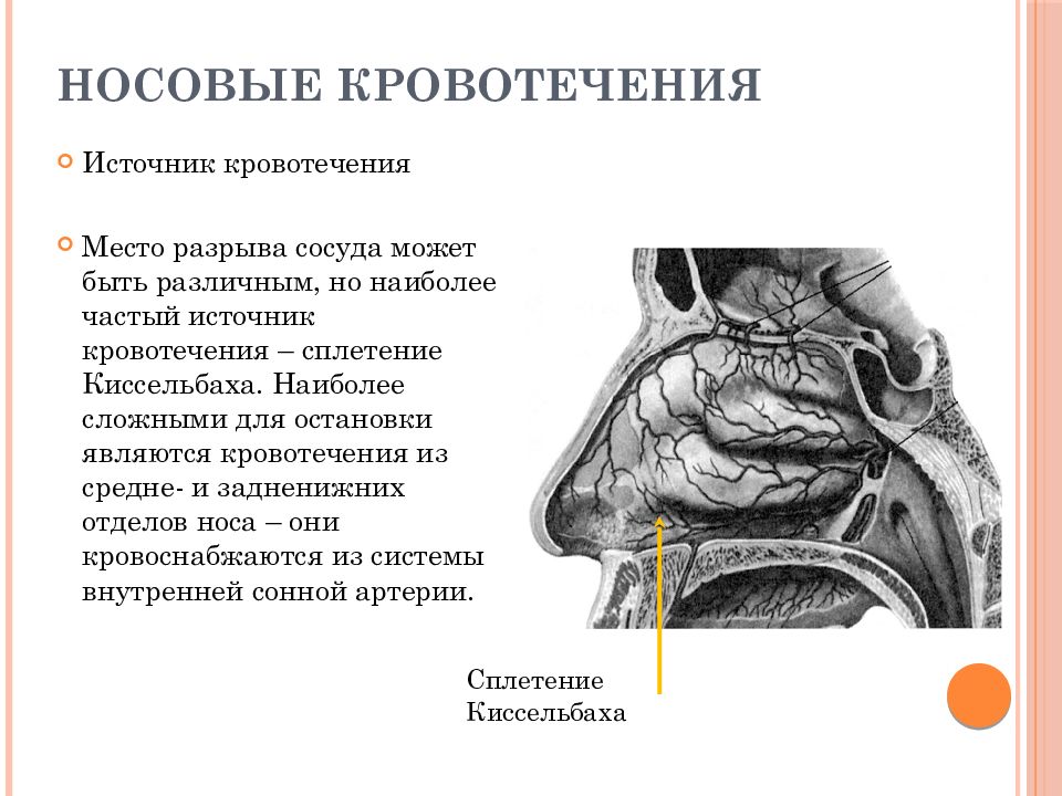 Носовые кровотечения клиническая картина