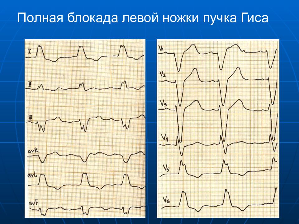 Презентация пропедевтика экг