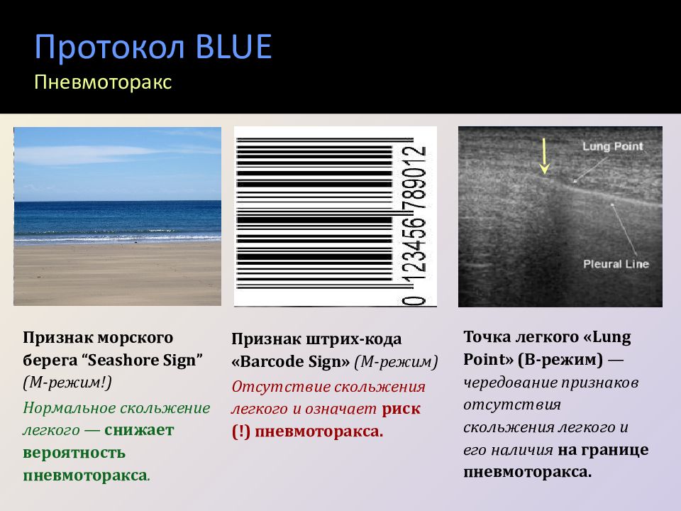 Режим отсутствия. Blue протокол УЗИ. Blue протокол исследования легких. УЗИ легких протокол. Blue протокол УЗИ легких.