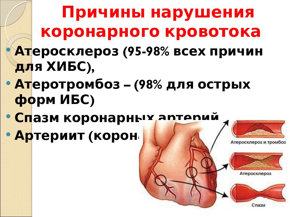 Ишемия отзывы. ИБС атеросклероз коронарных артерий. Причины нарушения коронарного кровотока. ИБС (коронарная болезнь сердца).
