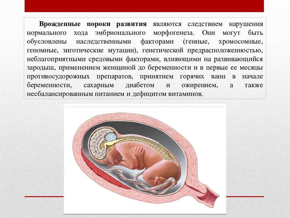 Врожденные пороки развития. Внутриутробные пороки развития. Врожденные аномалии развития. Пороки развития генные.